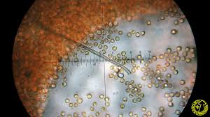 Attēlu rezultāti vaicājumam “Lycogala conicum”