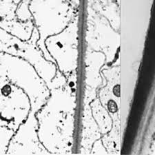 Attēlu rezultāti vaicājumam “Mnium hornum sporophyte”