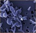 New device can detect infectious disease quickly | TopNews