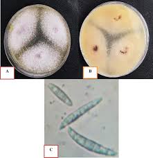 Attēlu rezultāti vaicājumam “Trichia flavicoma spores”