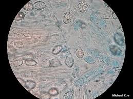 Attēlu rezultāti vaicājumam “Scutellinia scutellata”