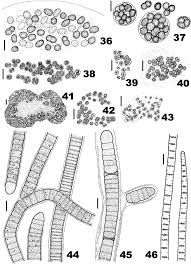 Attēlu rezultāti vaicājumam “Gloeocapsa rupestris”