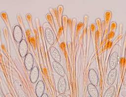 Attēlu rezultāti vaicājumam “Licea castanea spores”