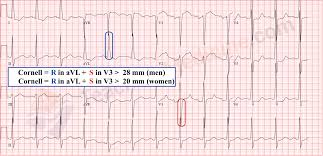 Image result for  ^ L V [ h    