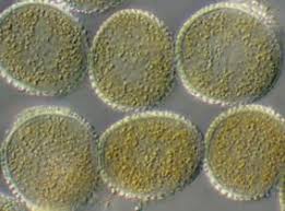 Attēlu rezultāti vaicājumam “Melampsora magnusiana”