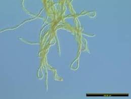 Attēlu rezultāti vaicājumam “Licea minima sessile”