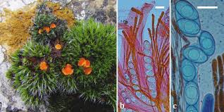 Attēlu rezultāti vaicājumam “Octosporella jungermanniarum”