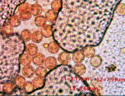 Attēlu rezultāti vaicājumam “Arcyria helvetica”