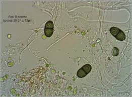 Attēlu rezultāti vaicājumam “Physconia distorta”