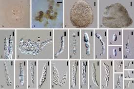 Attēlu rezultāti vaicājumam “Colloderma oculatum spores”