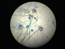Attēlu rezultāti vaicājumam “Trichia botrytis spores”