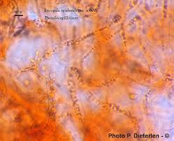 Attēlu rezultāti vaicājumam “Lycogala persicum spores”