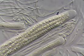 Attēlu rezultāti vaicājumam “Petractis sp.”