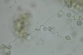 Attēlu rezultāti vaicājumam “Heterotrichia insignis (syn. Arcyria insignis) spores”