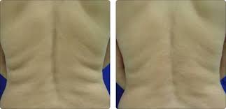 http://t0.gstatic.com/images?q=tbn:ANd9GcTebc8zLo9LFGmHUutT6bf-AvRViu4W2Q0bLf30eOcp2NOYjAHwIQ