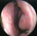 Saline Gel for Nasal Use     Dr Paulose