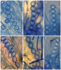 Attēlu rezultāti vaicājumam “Octosporella jungermanniarum”
