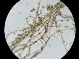 Attēlu rezultāti vaicājumam “Didymium serpula spores”