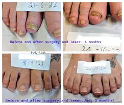 Image result for lunula nail