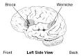 <b>Aphasia</b> - MossRehab ResourceNet