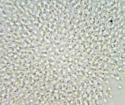 Attēlu rezultāti vaicājumam “Lichenoconium xanthoriae”