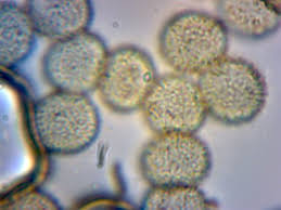 Attēlu rezultāti vaicājumam “Hemitrichia clavata spores”