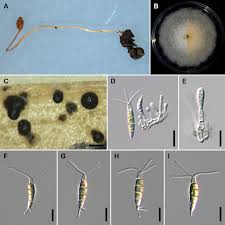 Attēlu rezultāti vaicājumam “Stemonitopsis aequalis var. microspora stalked”
