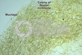Attēlu rezultāti vaicājumam “Nostoc commune cells”
