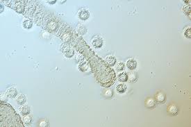 Attēlu rezultāti vaicājumam “Lycogala sp.”