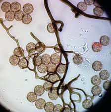 Attēlu rezultāti vaicājumam “Lycogala cf. oleocrystalliferum”