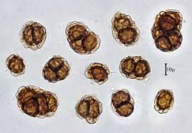 Attēlu rezultāti vaicājumam “Urocystis anemones spores”