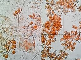 Attēlu rezultāti vaicājumam “Craterocolla cerasi”