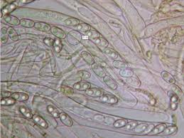 Attēlu rezultāti vaicājumam “Peziza badia”