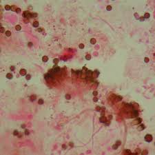 Attēlu rezultāti vaicājumam “Xanthoriicola physciae”