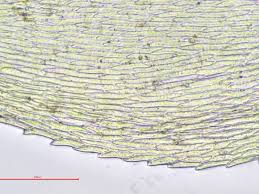 Attēlu rezultāti vaicājumam “Oxyrrhynchium hians var. rigidum”