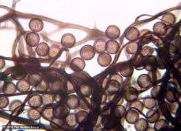 Attēlu rezultāti vaicājumam “Stemonitis virginiensis spores”