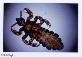 Attēlu rezultāti vaicājumam “Pediculus humanus capitis”