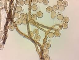 Attēlu rezultāti vaicājumam “Hemitrichia karstenii macro”