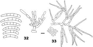 Attēlu rezultāti vaicājumam “Neonectria fuckeliana”