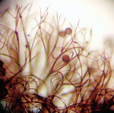 Attēlu rezultāti vaicājumam “Lamproderma pseudomaculatum”