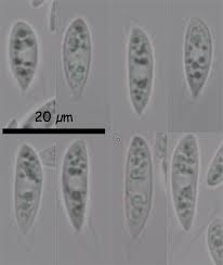 Attēlu rezultāti vaicājumam “Hymenoscyphus calyculus”