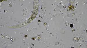 Attēlu rezultāti vaicājumam “Tranzschelia pruni-spinosae spores”