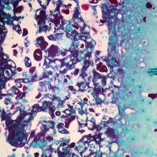 Attēlu rezultāti vaicājumam “Physarum virescens plasmodium”