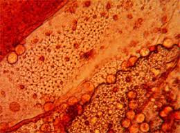 Attēlu rezultāti vaicājumam “Arcyria helvetica spores”