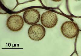 Attēlu rezultāti vaicājumam “Craterium aureonucleatum spores”
