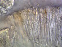 Attēlu rezultāti vaicājumam “Biatora sphaeroides”