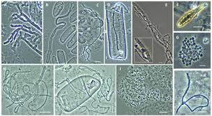 Attēlu rezultāti vaicājumam “Enteridium liceoides spores”