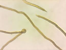 Attēlu rezultāti vaicājumam “Trichia contorta”