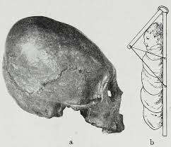 Image result for elongated skulls