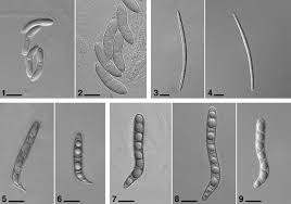 Attēlu rezultāti vaicājumam “Lasiosphaeria ovina”